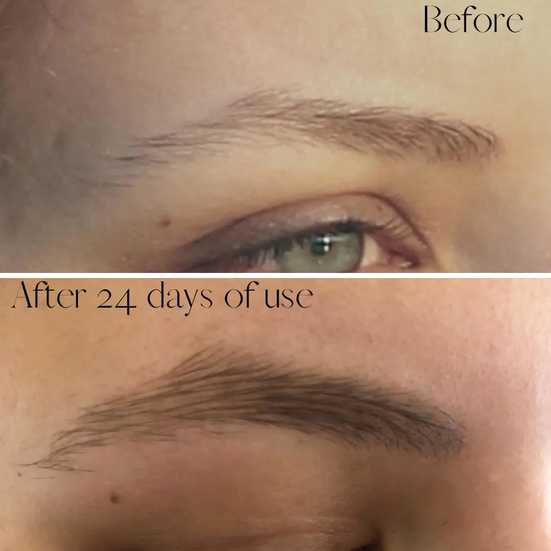 Brow Grow Advanced Conditioning Serum 2ml | Strengthen and Thicken Sparse Eyebrows - Image 6