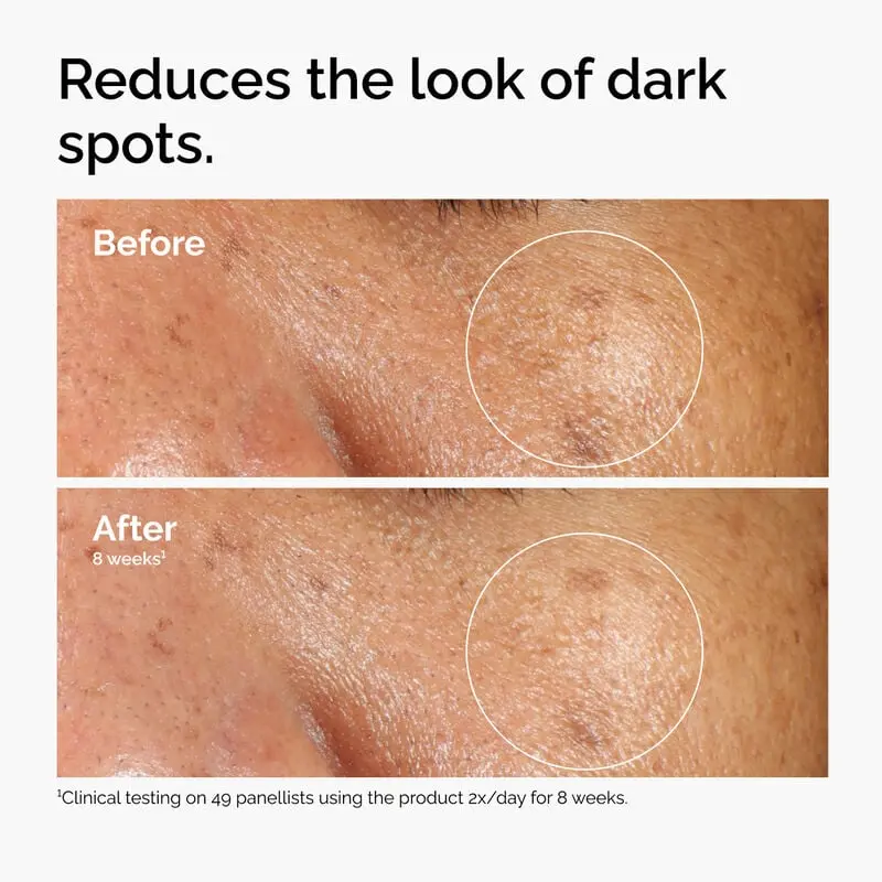 The Ordinary Alpha Arbutin 2% + Ha 60ML - Image 5