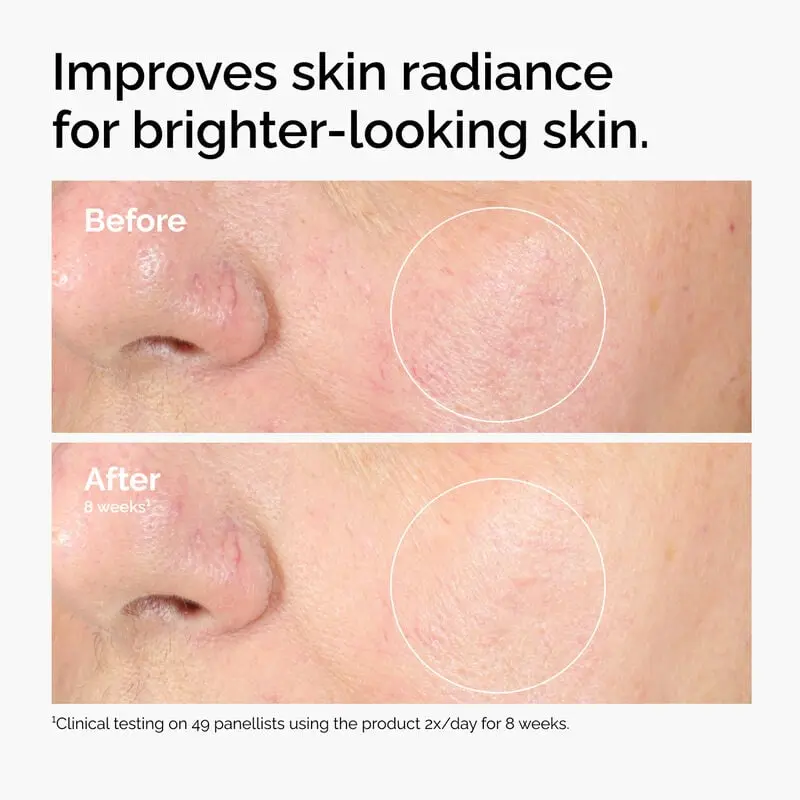 The Ordinary Alpha Arbutin 2% + Ha 60ML - Image 6