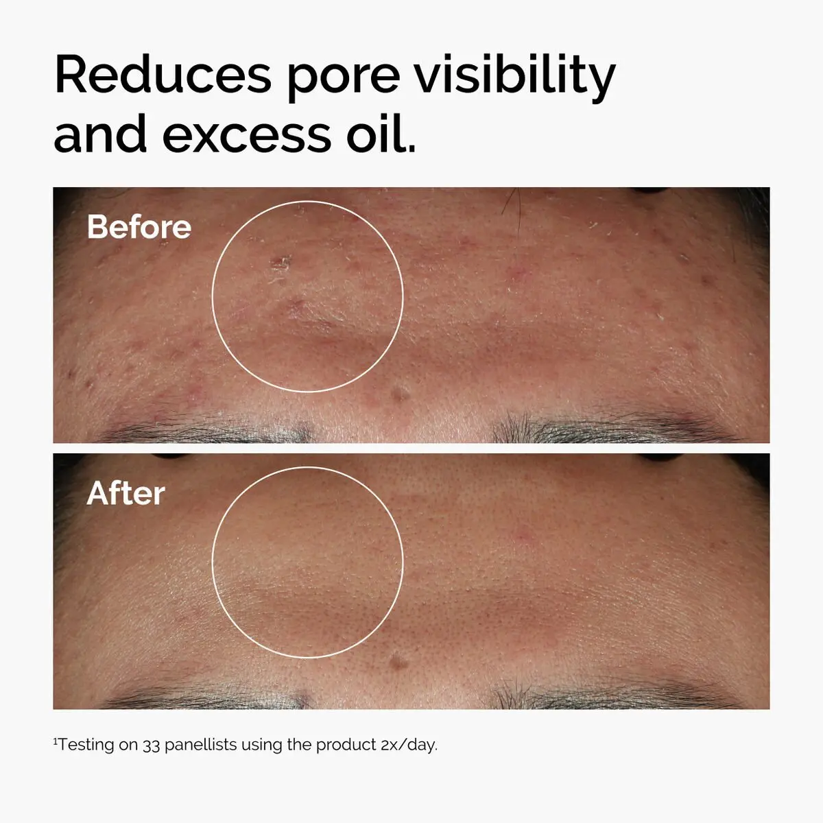 The Ordinary Niacinamide 10% + Zinc 1% 30ML - Image 5