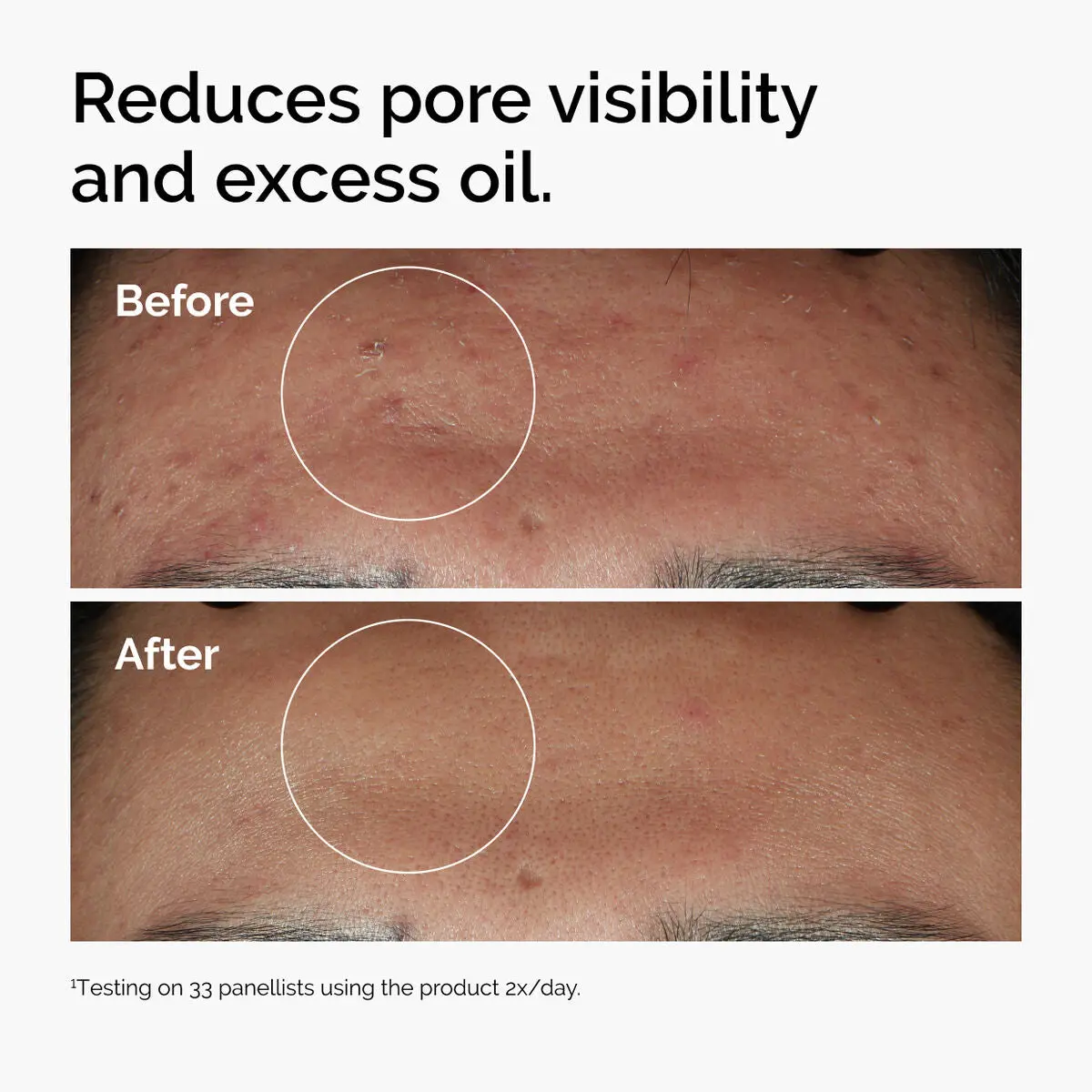The Ordinary Niacinamide 10% + Zinc 1% 60ML - Image 5